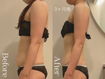 ユーフォリア グロウ(euphoria glow)/{ ラフォス90分×EMS15回 }