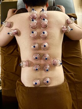 クレオーラ(Creola)/カッピング　付着時