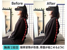 整体院 爽良/【札幌/大通り】姿勢改善