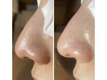 フラリス(fraris)/