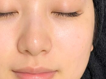 インパクト 問屋町(IMPACT)の写真/産毛を整えて、ワントーン明るい素肌へ。化粧ノリのいい肌へ