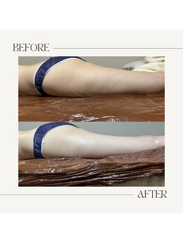 ルーチェアルバ(Luce Alba)の写真/理想のボディラインのシルエットを綺麗に!ダイエットで自信あふれる私へ☆整える技術◎