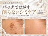 【長崎エリア新登場】パッチではがす！削らない美白ケア初回￥4,400