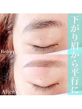 パルミエ(Palmier)/下がり眉でお悩みのあなたへ