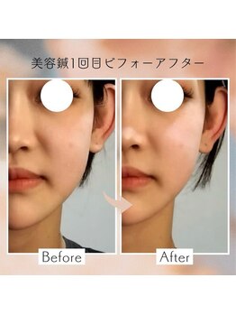 一樹鍼灸院/美容鍼灸