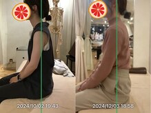 グレフル鍼灸接骨院 整体院 心斎橋/