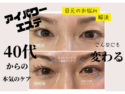 サロンドグリッター 材木町店(salon de glitter)の写真