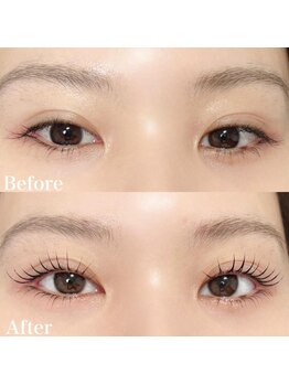 レピア 郡山駅前店/韓国式LEPIA Before&After