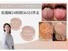 【ニキビ原因特定カウンセリング】まずは話したい方/看護師根本分析◆施術無