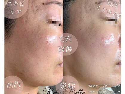 ルリエベル(Relier Belle)の写真