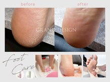 つやつや素足へ♪充実のフットケアメニュー【角質ケア】でなめらかに。思わず見せたくなる足元へ！