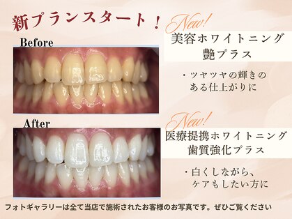 セイ(sei)の写真