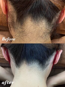 ジューンブライド(June Bride 61)/えり足脱毛