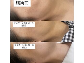 ミラージュ(Milarju)/大人気!!ラミネーションピール☆
