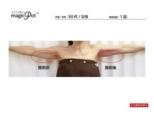 トータルケア・マッサージ 都立大学/痩身マシン・参考写真（4）