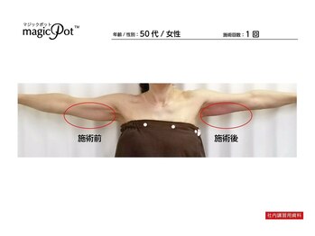 トータルケア・マッサージ 都立大学/痩身マシン・参考写真(4)