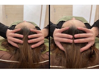 エミット(emit)/小顔矯正