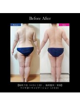 アディクト(Addict)/Before＆After