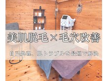 サンテ(Sante)