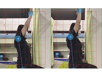 整骨院こころ 祇園院/可動域の変化