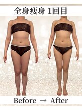 ドレス(dress)/全身痩身Before/After