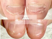 グラシナ なんば店の雰囲気(一回の施術で美しい爪へ【自爪育成/長さだし/深爪/フィルイン】)