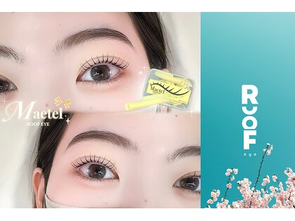 ルーフアイ(ROOF EYE)の写真