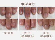 ハンド ケイ(Hand K)
