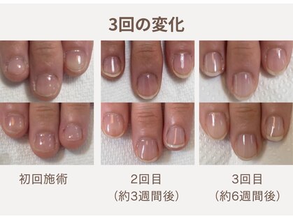 ハンド ケイ(Hand K)の写真