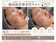 ベルサロン(Belle salon)