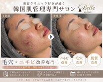 ベルサロン(Belle salon)