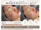 ベルサロン(Belle salon)の写真