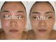 サロンベル(Salon Belle)の写真/リラックス空間で理想の小顔へ♪口コミ紹介多数!男性も大歓迎の専門サロン◎