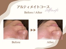グラサヴォーグ 堺なかもず店