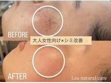 レアナチュラルケアサロン(Lea natural care salon)