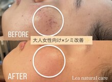 レアナチュラルケアサロン(Lea natural care salon)