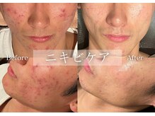 シューラディアント(ShuRadiant)/お顔の悩みならお任せください