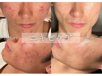 シューラディアント(ShuRadiant)/お顔の悩みならお任せください