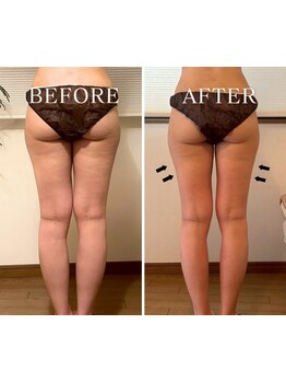 美脚になりたい