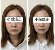 おおの鍼灸接骨院
