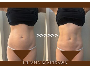 リリアーナ アサヒカワ(LILIANA ASAHIKAWA)/美ボディメイク（ウエスト）