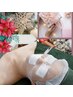 ☆クリスマス 短期集中美肌プラン☆【ニキビ緩和 予防・乾燥シミくすみケア】