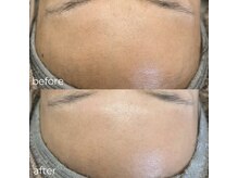 ハイク バイ ジェン(HIKE by gen.)/フェイシャルワックス