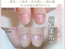 カピリナ(Ka Pilina)の雰囲気（もう隠さない。噛み爪・深爪の自爪育成）