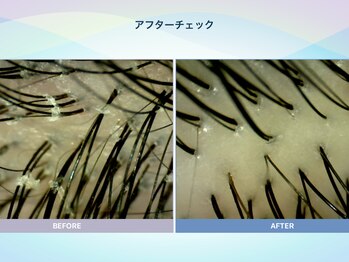 アンス(anth:)/お客様の仕上がり