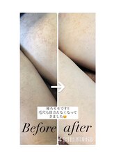 ツリービューティー(Tree Beauty)/★毛穴なレスな美肌へ！★