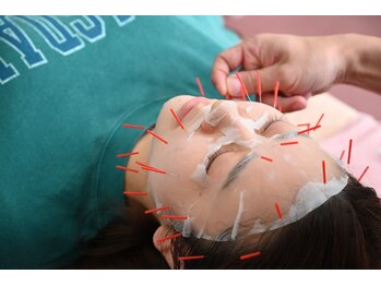 稲川鍼灸接骨院/施術風景