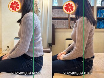 グレフル鍼灸接骨院 整体院 心斎橋/