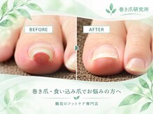 巻き爪研究所 鶴見院