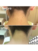 パーソナルエステティックサロン リボーン(ReBorn)/うなじも綺麗に剃って脱毛！